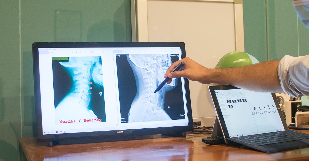 Vitality Chiro Featured Image
