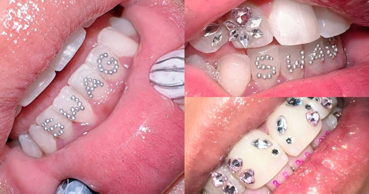 Tooth Gem Studio - Tooth Candy