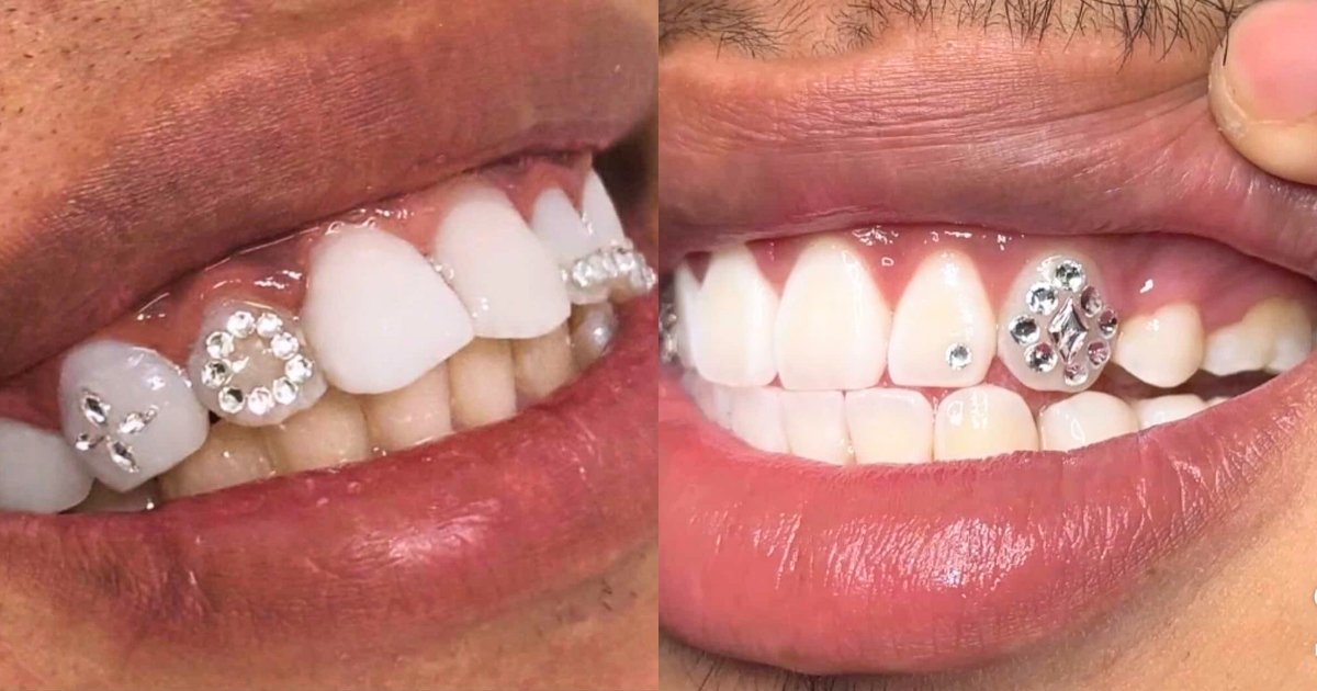 Tooth Gem Studio - ToothGemsSg