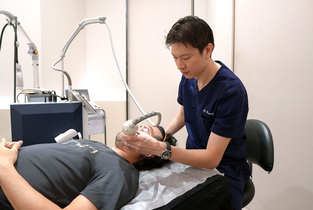 clifford rf microneedle doctor